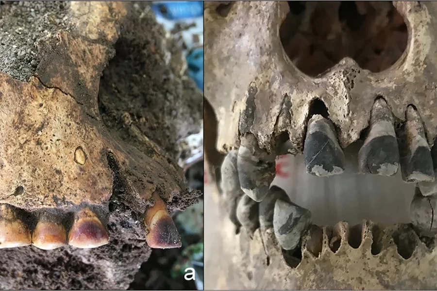 dentes-pretos-vietna