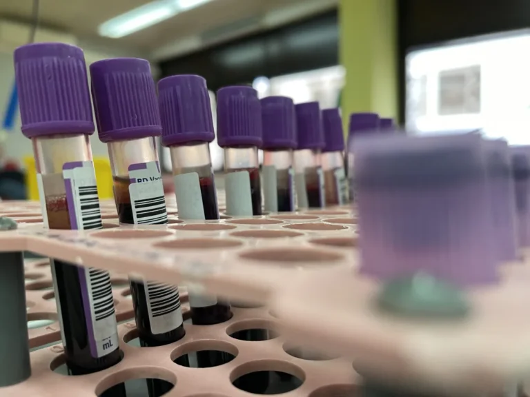 Estudo aponta que jejum universal para exames de sangue é desnecessário