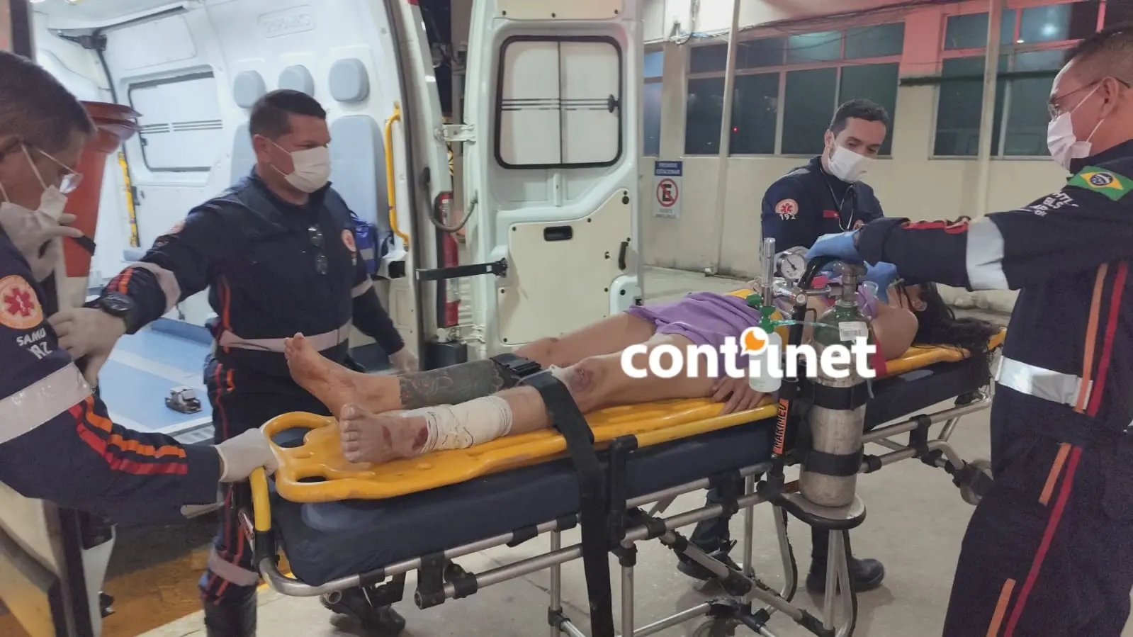 Jovem fica em estado gravíssimo após ser atingida por carro e bater em poste